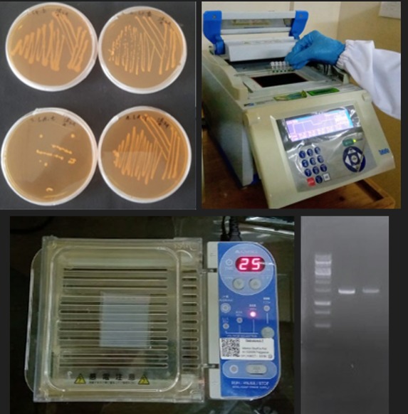 Microbial DNA amplification using 16S rRNA, 28Sr RNA and ITS sequences