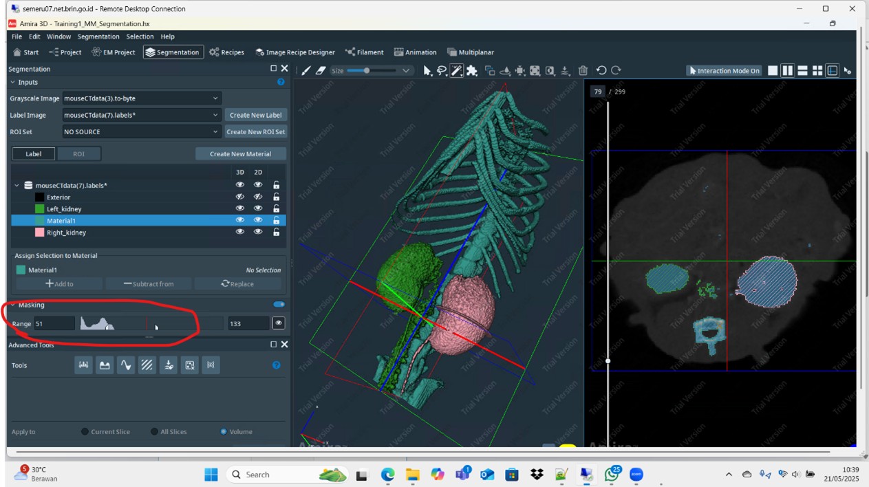 Bimbingan Teknis Pengunaan Software AMIRA – 3D Reconstruction 